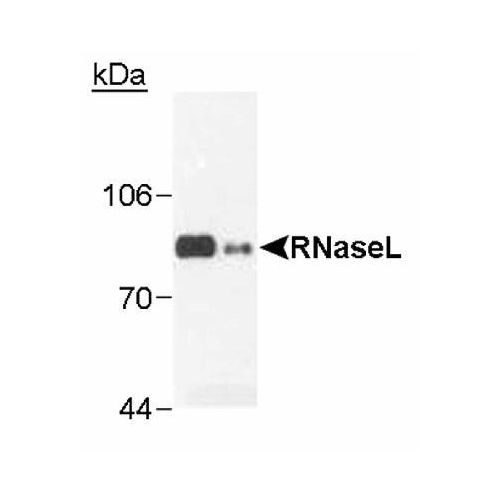 Ribonuclease L (RNaseL) antibody (2E9)