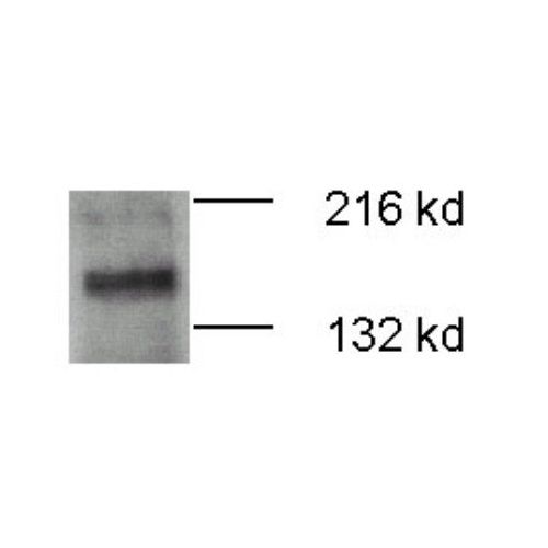 ATP7b antibody