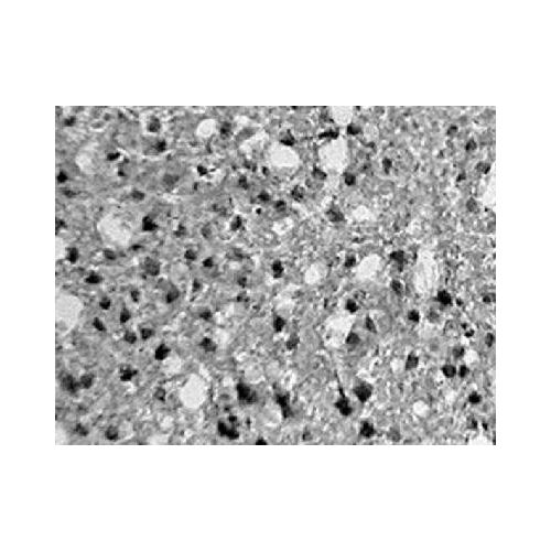 Hypoxia-inducible factor 1-alpha inhibitor (FIH-1) antibody