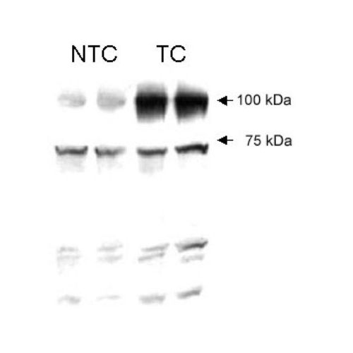 Vasculogenesis gene on 5q (VG5Q) antibody