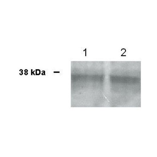 Transitional epithelial response protein 1 (TERE1) antibody