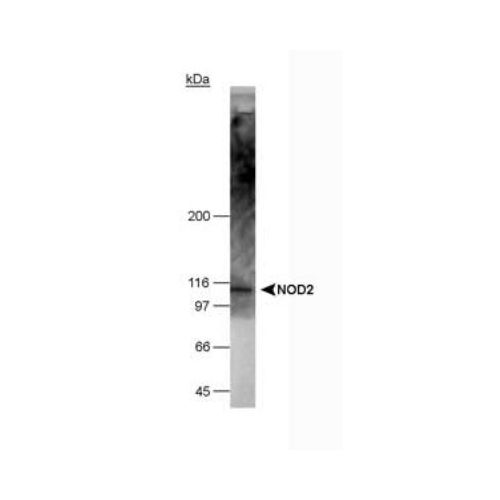 NOD2 antibody (2D9)