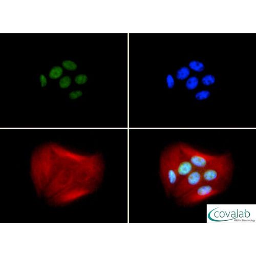 Breast cancer type 1 susceptibility protein antibody