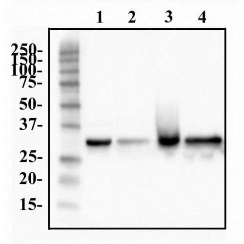 Heterogeneous nuclear ribonucleoprotein A1 (hnRNP A1) antibody