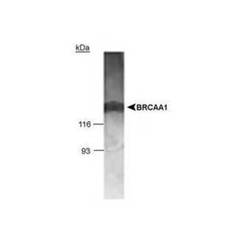 Breast cancer-associated antigen BRCAA1 antibody