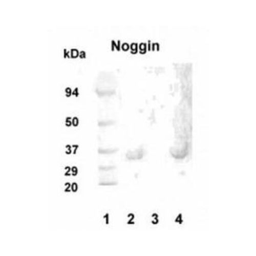 Noggin antibody