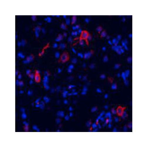 Metabotropic Glutamate Receptor 1a antibody