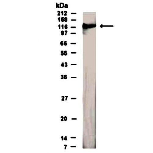 SEMA4D antibody