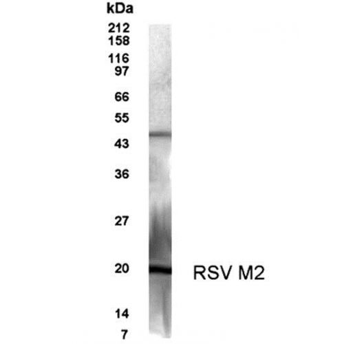 Respiratory Syncytial Virus M2 protein antibody