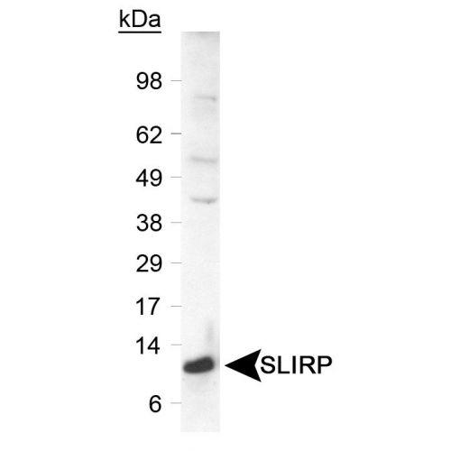 SRA stem-loop interacting RNA binding protein (SLIRP) antibody