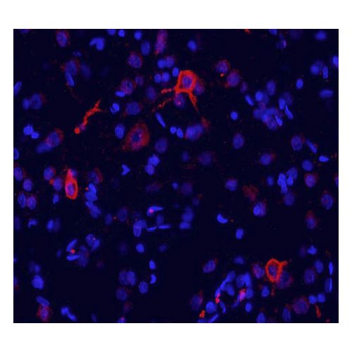 metabotropic Glutamate Receptor 1a antibody