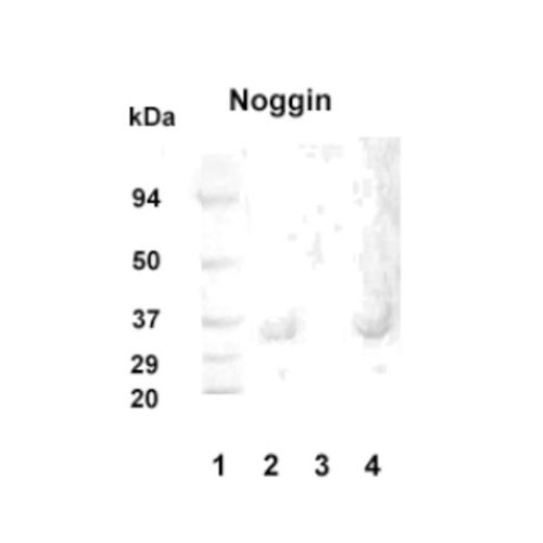 Noggin antibody