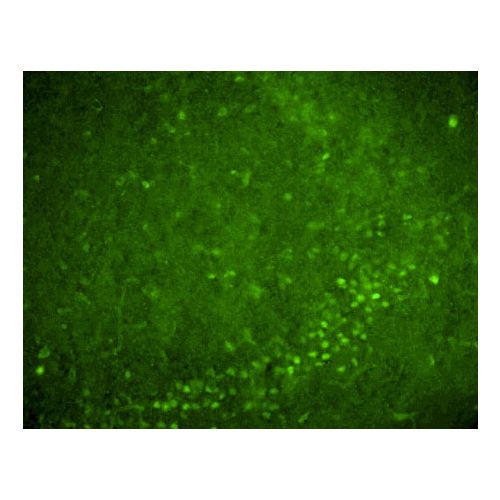 Nurr1 antibody