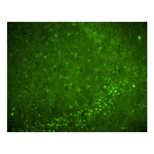 Nurr1 antibody