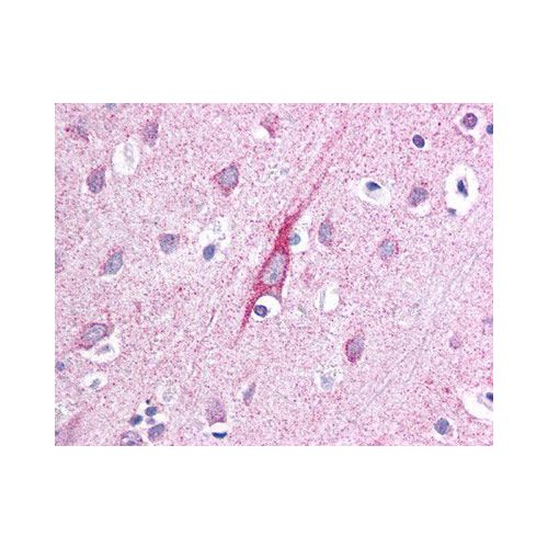Probable cation-transporting ATPase 13A2 antibody