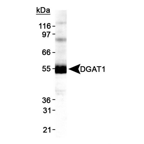 Diacylglycerol O-acyltransferase 1 antibody