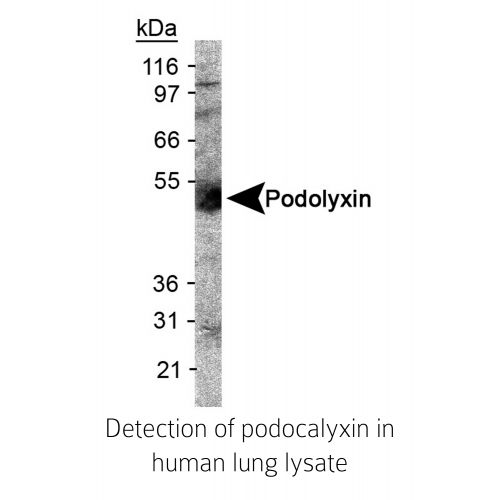 Podocalyxin antibody