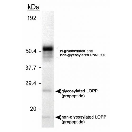 LOX propeptide antibody