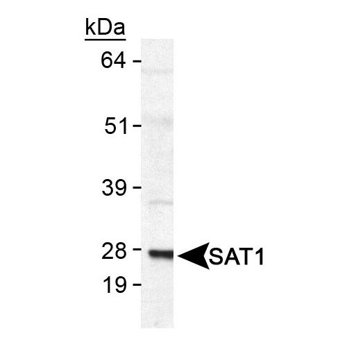 SAT1 antibody