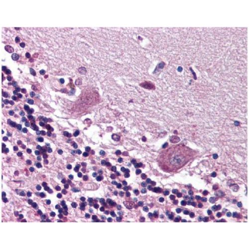 Cerebellar degeneration-related protein 2 antibody