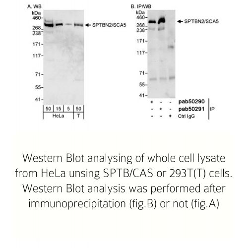 Spectrin beta 3 antibody