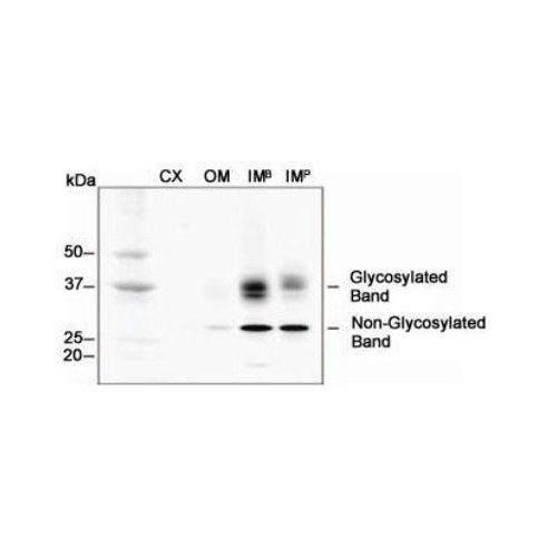 Aquaporin-2 (AQP-2) antibody