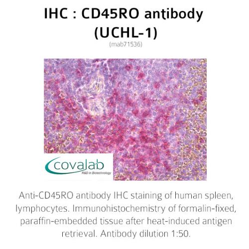 CD45RO antibody (UCHL-1)