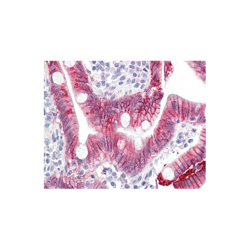 IL-17 (aa1-75) antibody (4K5F6)