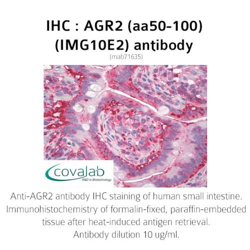 AGR2 (aa50-100) antibody (IMG10E2)