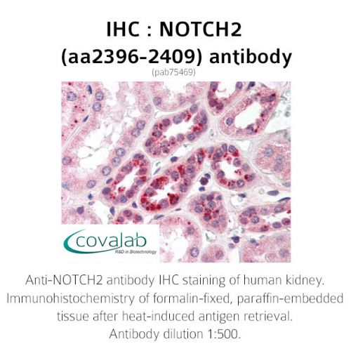 NOTCH2 (aa2396-2409) antibody