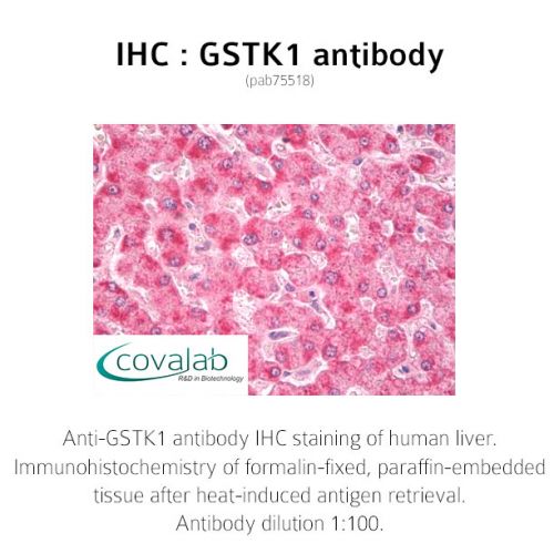 GSTK1 antibody