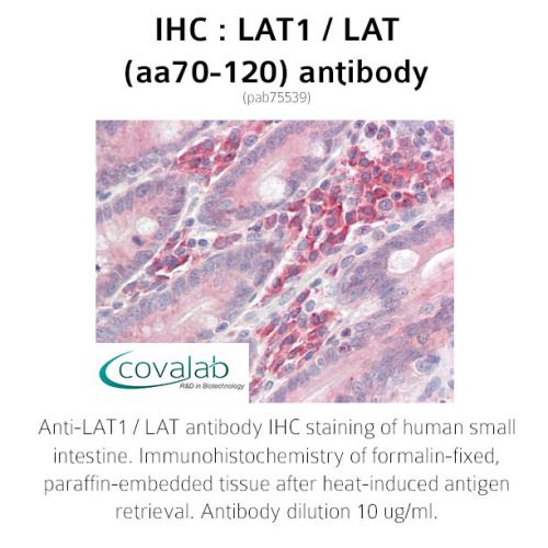 LAT1 / LAT (aa70-120) antibody