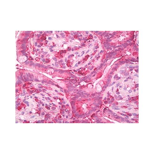 Chymotrypsin antibody