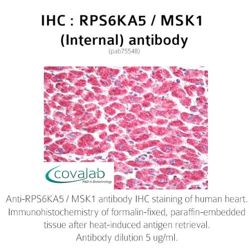 RPS6KA5 / MSK1 (Internal) antibody