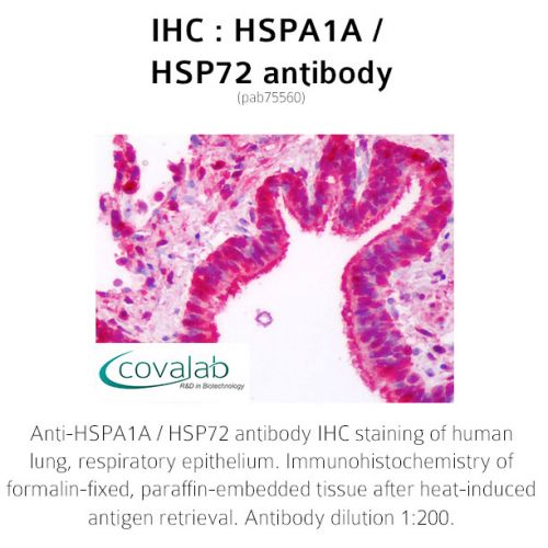 HSPA1A / HSP72 antibody
