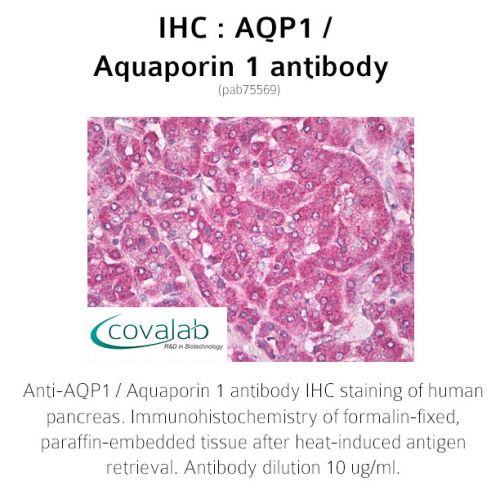 AQP1 / Aquaporin 1 antibody