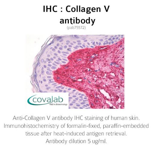 Collagen V antibody<br/>(pab75572)<br/>Anti-Collagen V antibody IHC of human skin. Immunohistochemistry of formalin-fixed, paraffin-embedded tissue after heat-induced antigen retrieval. Antibody dilution 5 µg/ml.