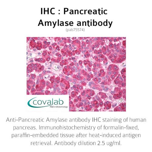 Pancreatic Amylase antibody