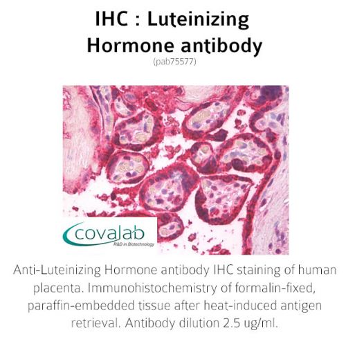 Luteinizing Hormone antibody