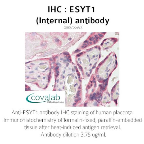 ESYT1 (Internal) antibody