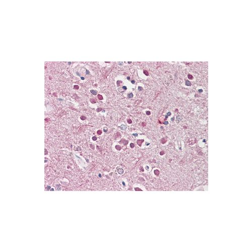 CHRNB2 (Internal) antibody