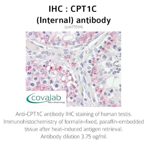 CPT1C (Internal) antibody