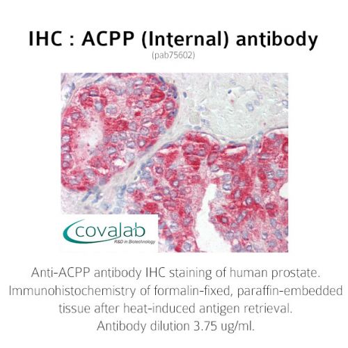 ACPP (Internal) antibody