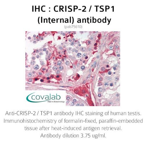 CRISP-2 / TSP1 (Internal) antibody