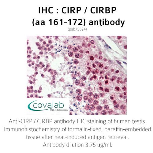 CIRP / CIRBP (aa 161-172) antibody