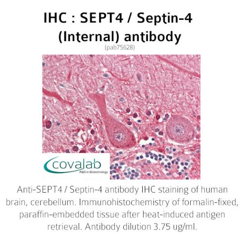 SEPT4 / Septin-4 (Internal) antibody