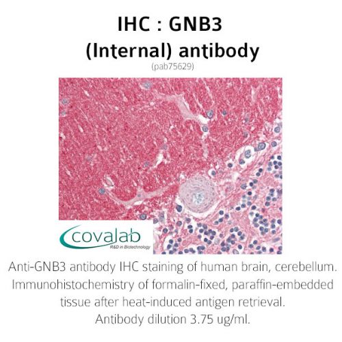GNB3 (Internal) antibody