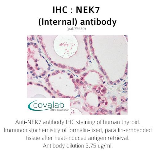 NEK7 (Internal) antibody