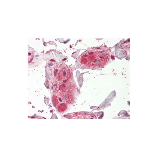 CHRNA5 (Internal) antibody
