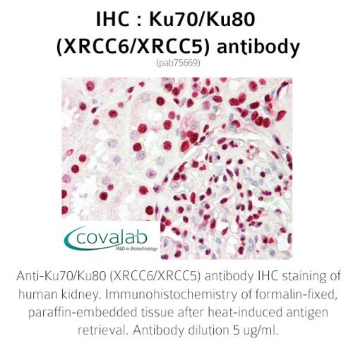 Ku70/Ku80 (XRCC6/XRCC5) (XRCC6/XRCC5) antibody